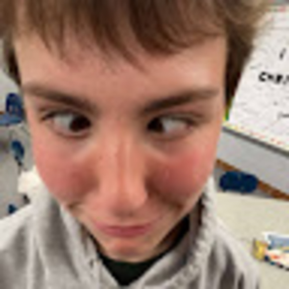 Meet your Posher, Joey - Picture 1 of 1